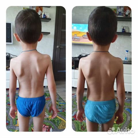 Детский массаж