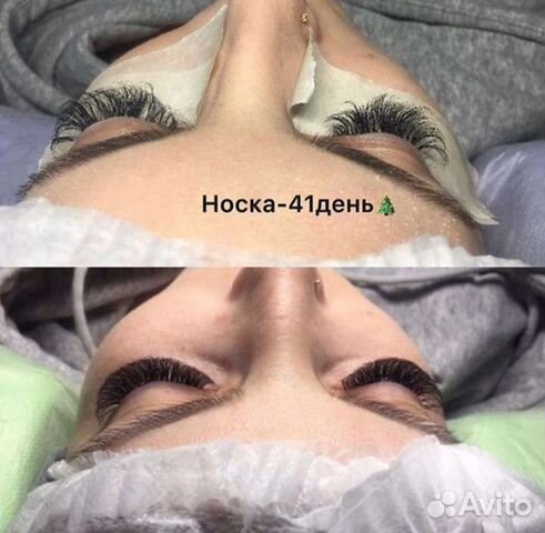 Наращивание ресниц